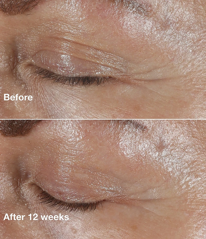 Clinique Smart Clinical Repair Wrinkle Correcting Eye Cream