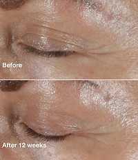 Clinique Smart Clinical Repair Wrinkle Correcting Eye Cream