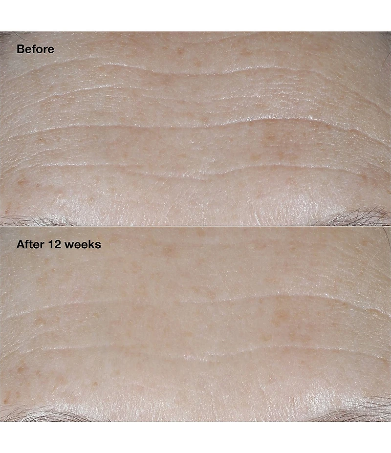 Clinique Smart Clinical Repair Wrinkle Correcting SPF30 Moisturizer