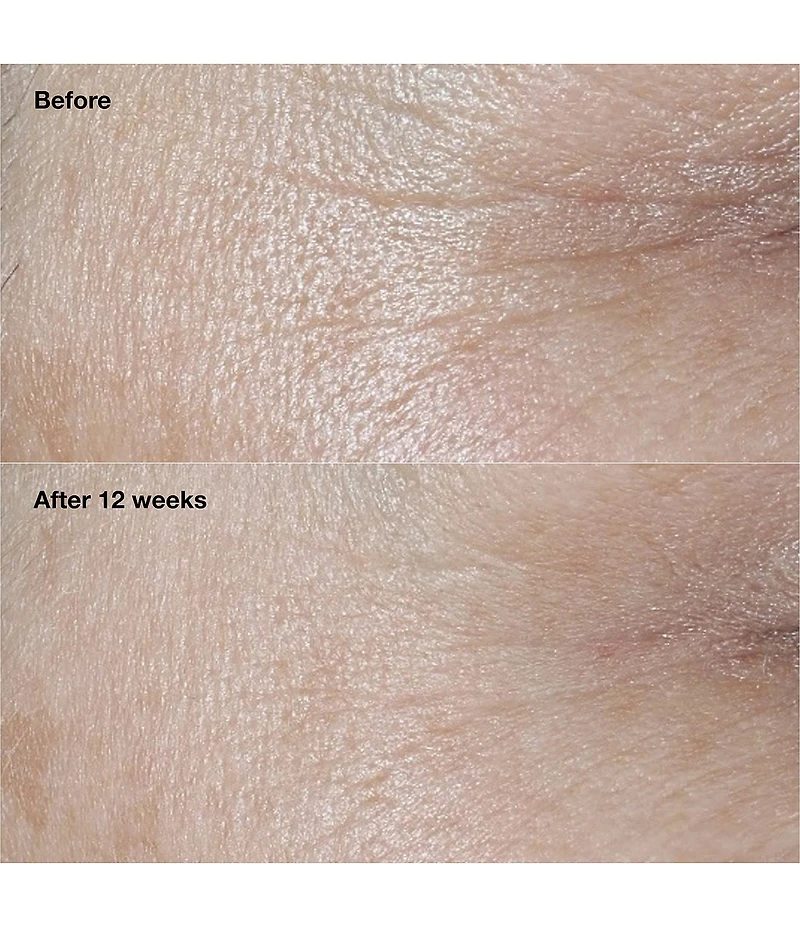Clinique Smart Clinical Repair Wrinkle Correcting SPF30 Moisturizer
