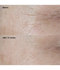 Clinique Smart Clinical Repair Wrinkle Correcting SPF30 Moisturizer