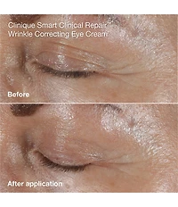 Clinique Wrinkle Fighting Routine Anti-Aging Skincare Gift Set