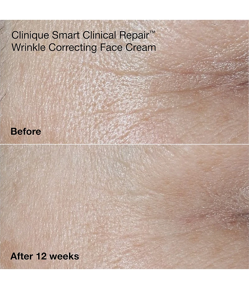 Clinique Wrinkle Fighting Routine Anti-Aging Skincare Gift Set