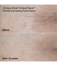 Clinique Wrinkle Fighting Routine Anti-Aging Skincare Gift Set