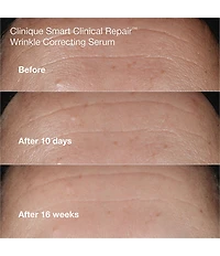 Clinique Wrinkle Fighting Routine Anti-Aging Skincare Gift Set