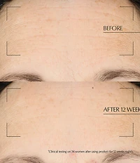 Estee Lauder Advanced Night Repair Moisturizing Overnight Treatment with Hyaluronic Acid