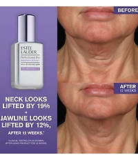 Estee Lauder Perfectionist Pro Rapid Firm + Lift Serum Duo