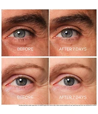 Guerlain Abeille Royale Youth Repair Eye Cream for Wrinkles and Brightening