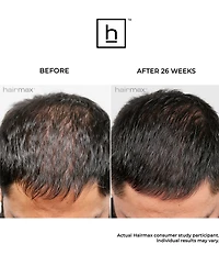 Hairmax LaserBand 41 ComfortFlex