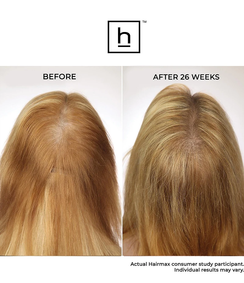 Hairmax LaserBand 41 ComfortFlex