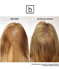 Hairmax Laserband 82 Comfort