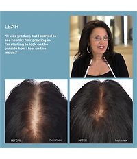 Hairmax LaserComb Ultima 12 Classic