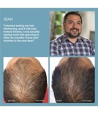 Hairmax LaserComb Ultima 12 Classic