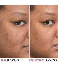 IT Cosmetics Bye Bye Dark Spots Niacinamide Serum