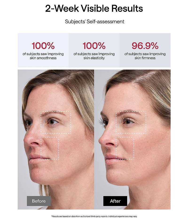 JMOON by Ulike UCollagen + Basic Set