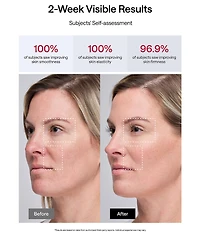 JMOON by Ulike UCollagen + Basic Set