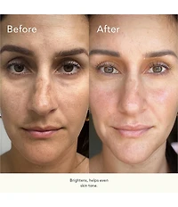 Kat Burki Skincare Biocell Correcting Serum
