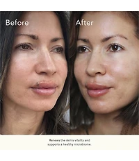 Kat Burki Skincare PH + Enzyme Essence