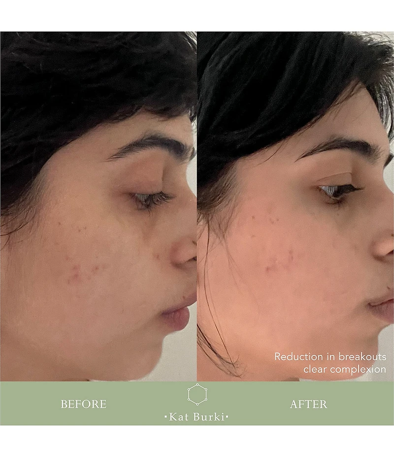 Kat Burki Skincare Vitabiome Active Skin Optimizer