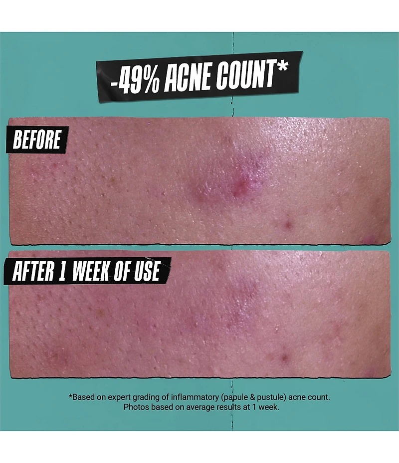Kiehl's Since 1851 Acne Treating Cleansing Paste