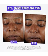 Kiehl's Since 1851 Clearly Corrective Dark Spot Solution
