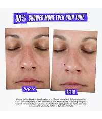 Kiehl's Since 1851 Clearly Corrective Dark Spot Solution