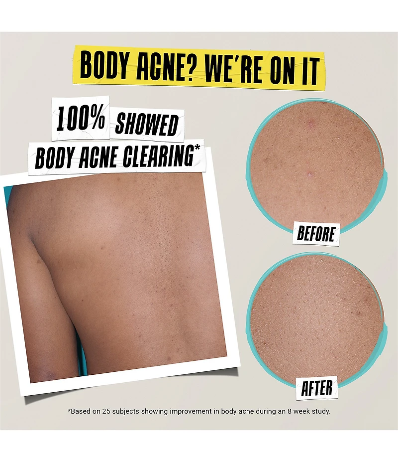Kiehl's Since 1851 Expertly Clear Acne Treating and Preventing Lotion