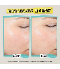 Kiehl's Since 1851 Expertly Clear Acne Treating and Preventing Lotion