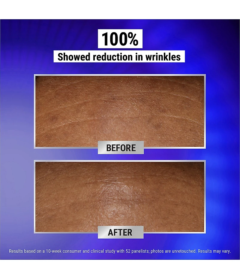 Kiehl's Since 1851 Fast Release Wrinkle-Reducing 0.3% Retinol Night Serum