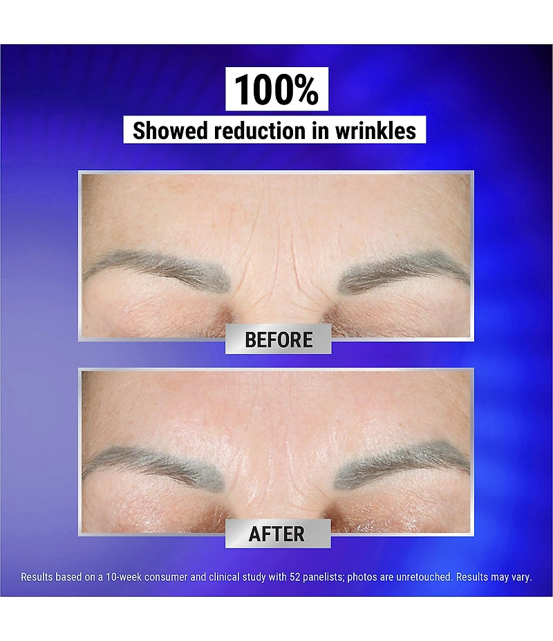 Kiehl's Since 1851 Fast Release Wrinkle-Reducing 0.3% Retinol Night Serum