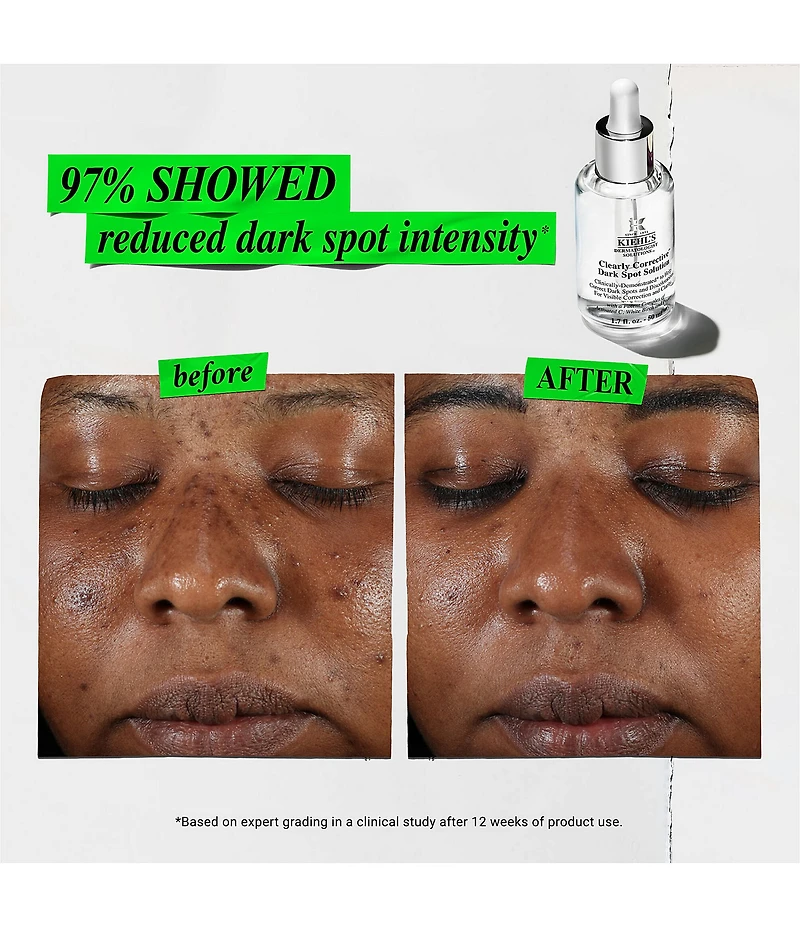 Kiehl's Since 1851 Radiance Revival - Spot Correction and Moisturizer Gift Set