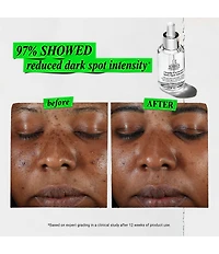 Kiehl's Since 1851 Radiance Revival - Spot Correction and Moisturizer Gift Set