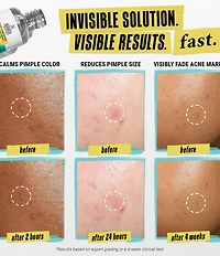 Kiehl's Since 1851 Truly Targeted Acne-Clearing Pimple Patch Solution with Salicylic Acid