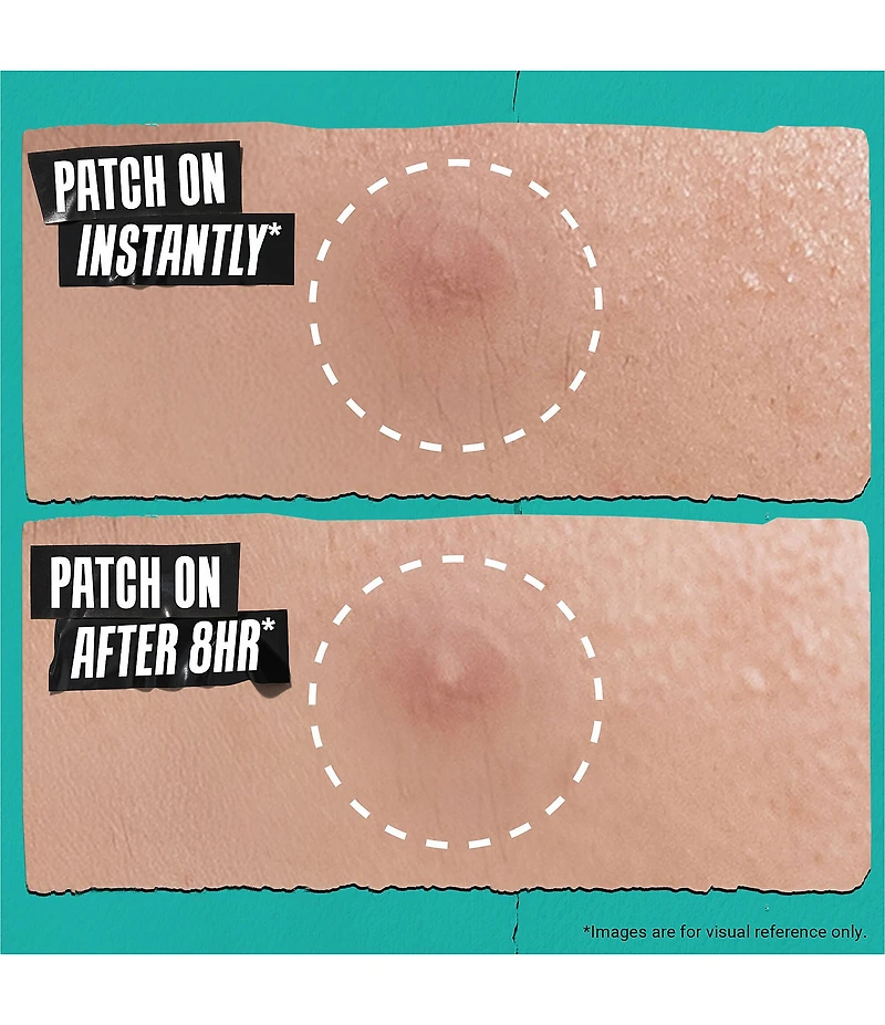 Kiehl's Since 1851 Truly Targeted Overnight Blemish Patch