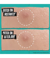 Kiehl's Since 1851 Truly Targeted Overnight Blemish Patch