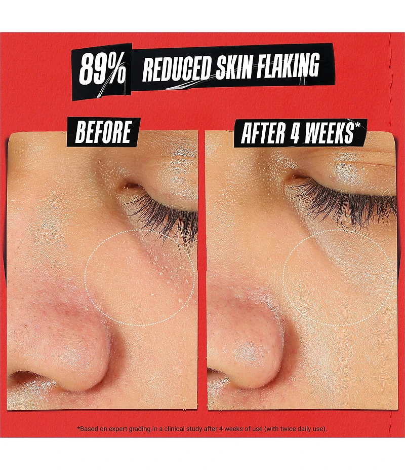 Kiehl's Since 1851 Ultra Facial Meltdown Recovery Medicated Cream