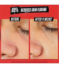 Kiehl's Since 1851 Ultra Facial Meltdown Recovery Medicated Cream