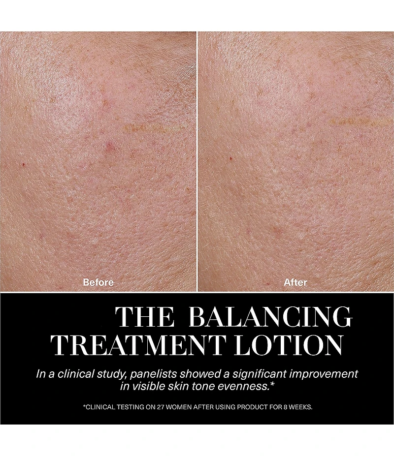 La Mer The Balancing Treatment Lotion