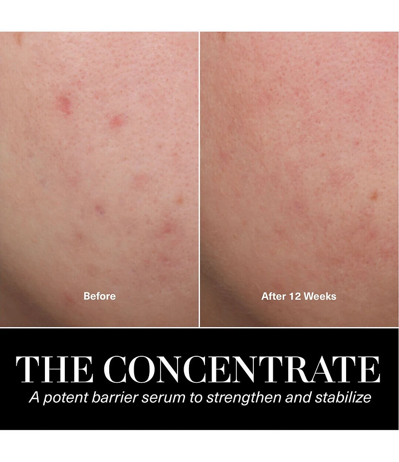 La Mer The Concentrate Serum