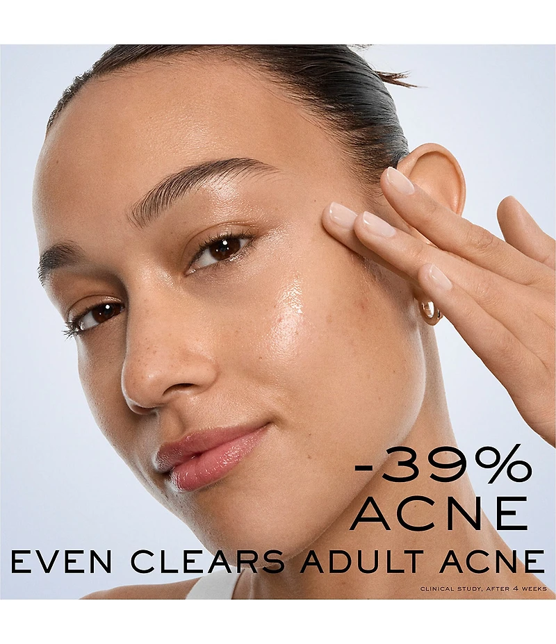 Lancome Clarifique Bx-Interceptor™ Acne Treatment with Glycolic & Salicylic Acid