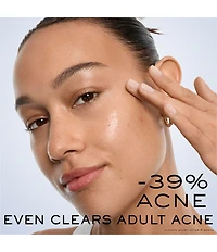 Lancome Clarifique Bx-Interceptor™ Acne Treatment with Glycolic & Salicylic Acid