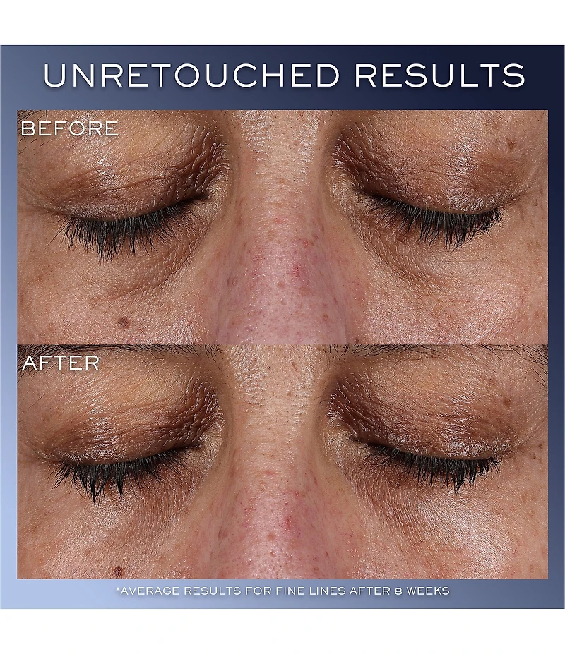 Lancome Genifique Ultimate Serum Skincare Set