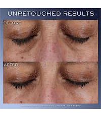 Lancome Genifique Ultimate Serum Skincare Set