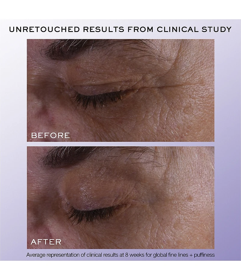 Lancome Renergie H.C.F. Triple Serum Eye