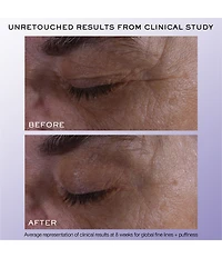 Lancome Renergie H.C.F. Triple Serum Eye