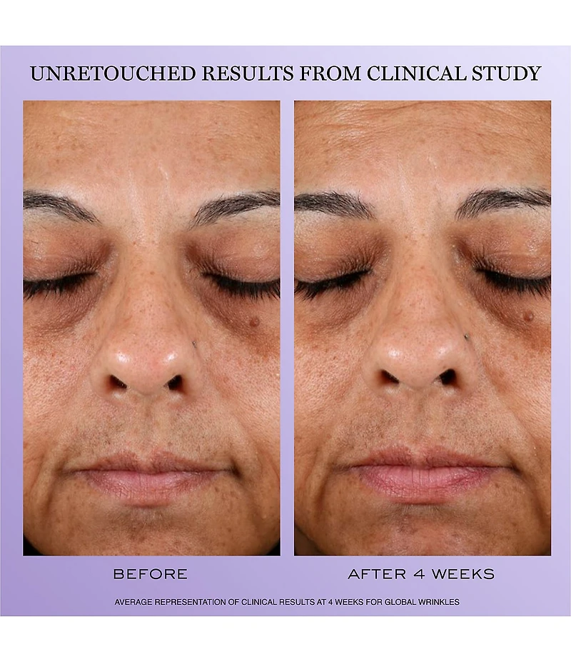 Lancome Renergie H.P.N. 300-Peptide Cream Skincare Set