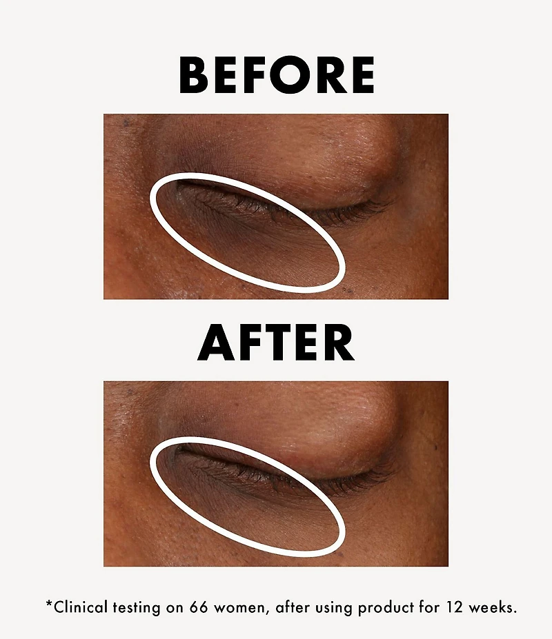 Origins GINZING™ VITAMIN C & Niacinamide Eye Cream To Brighten and Depuff