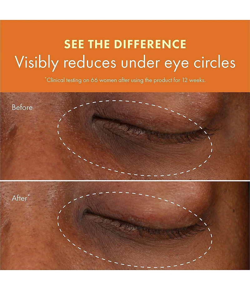Origins GINZING™ VITAMIN C & Niacinamide Eye Cream To Brighten and Depuff