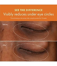 Origins GINZING™ VITAMIN C & Niacinamide Eye Cream To Brighten and Depuff