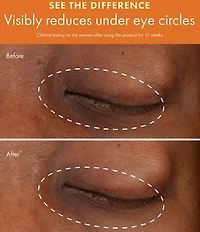 Origins GinZing™ Vitamin C & Niacinamide Brightening Eye Cream
